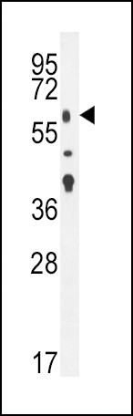 TGFBR2 Antibody in Western Blot (WB)