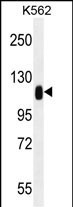 TRIM28 Antibody in Western Blot (WB)