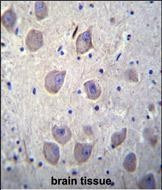 beta Arrestin 1 Antibody in Immunohistochemistry (Paraffin) (IHC (P))