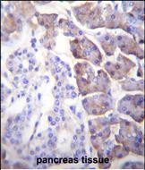 Carboxypeptidase B1 Antibody in Immunohistochemistry (Paraffin) (IHC (P))