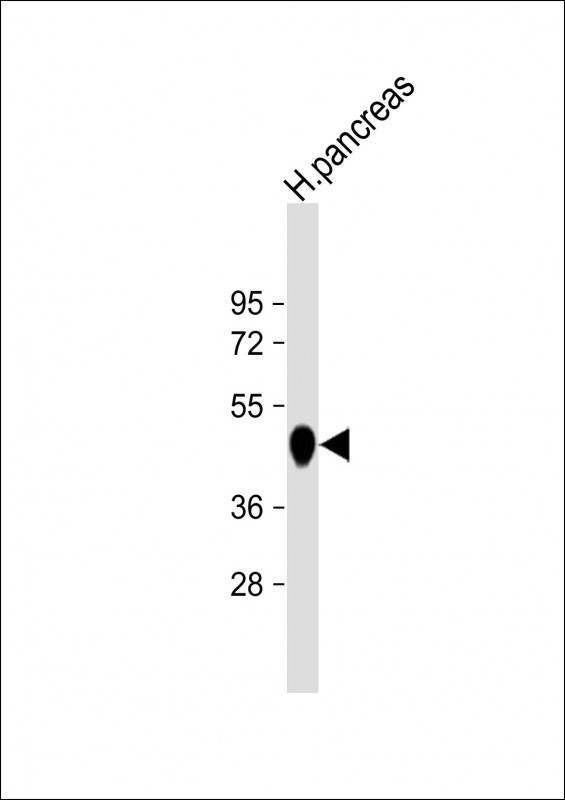 Carboxypeptidase B1 Antibody in Western Blot (WB)