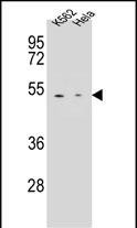 Carboxypeptidase B1 Antibody in Western Blot (WB)