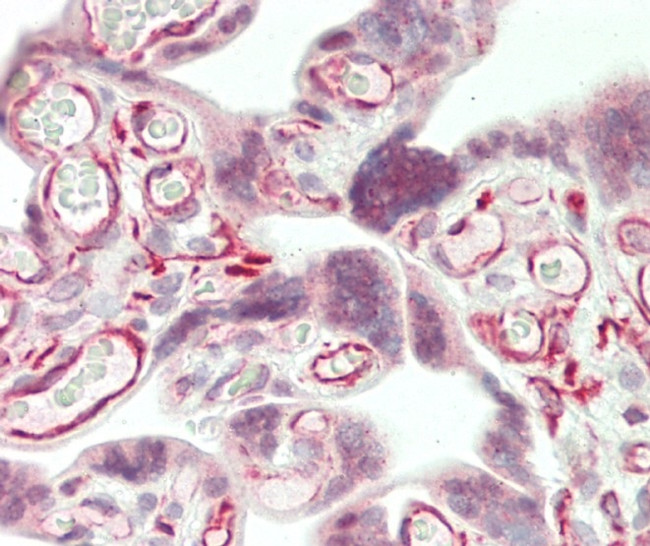 WRN Antibody in Immunohistochemistry (Paraffin) (IHC (P))