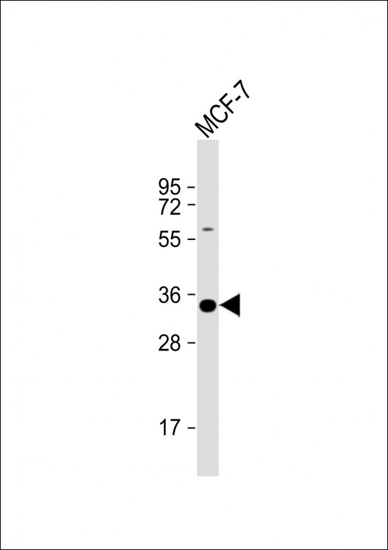 STUB1 Antibody in Western Blot (WB)