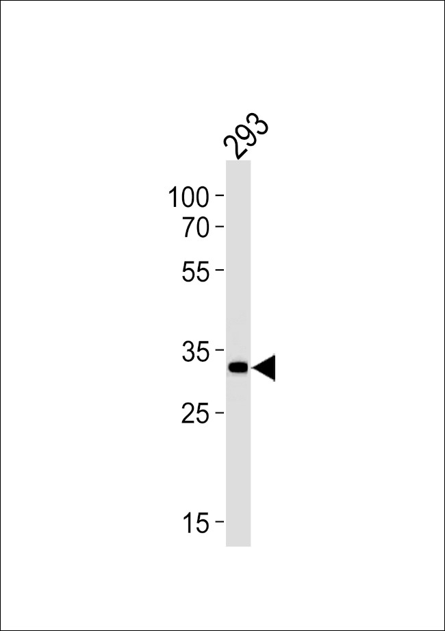 STUB1 Antibody in Western Blot (WB)