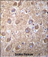 RASGRP2 Antibody in Immunohistochemistry (Paraffin) (IHC (P))