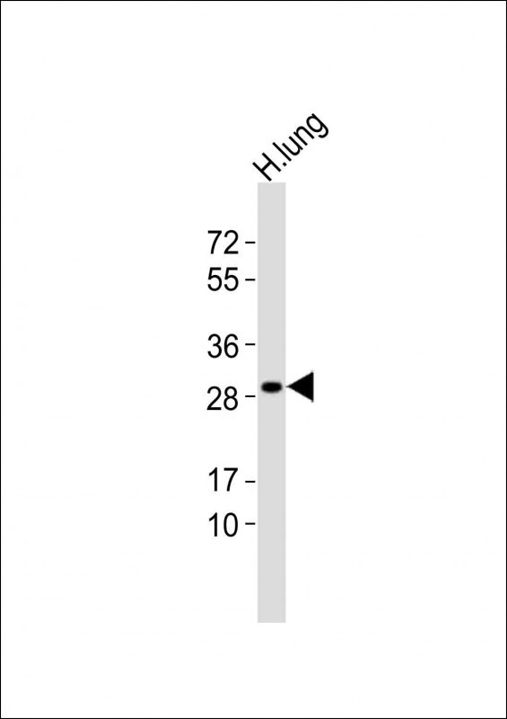 GSTT1 Antibody in Western Blot (WB)