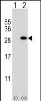 GSTT1 Antibody in Western Blot (WB)