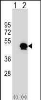 PAI1 Antibody in Western Blot (WB)