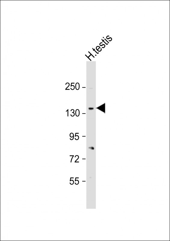 CACNA2D2 Antibody in Western Blot (WB)