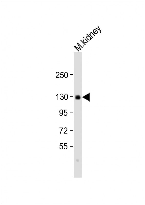 CACNA2D2 Antibody in Western Blot (WB)