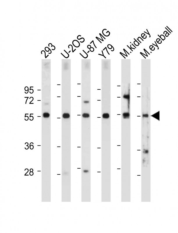 FOXD1 Antibody in Western Blot (WB)