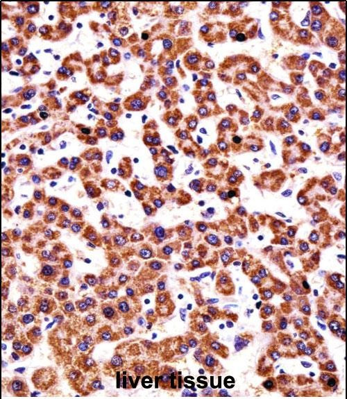 CYP2D6 Antibody in Immunohistochemistry (Paraffin) (IHC (P))