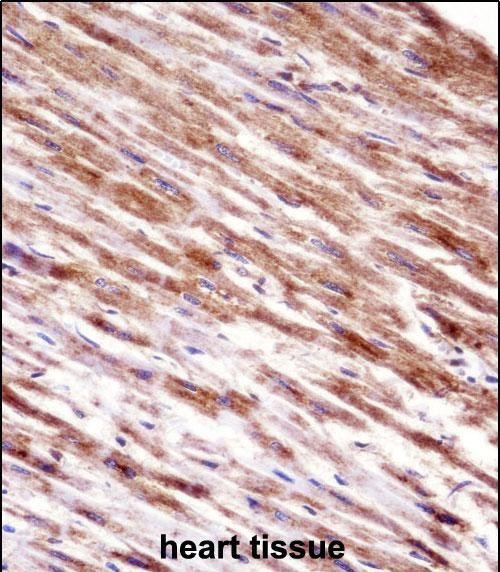 HSPBP1 Antibody in Immunohistochemistry (Paraffin) (IHC (P))