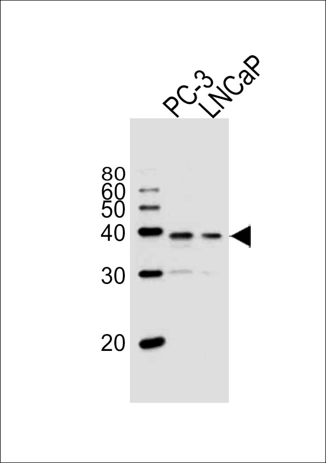 VDR Antibody in Western Blot (WB)