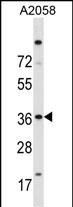 ISL2 Antibody in Western Blot (WB)