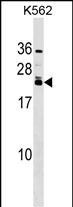 HAND2 Antibody in Western Blot (WB)