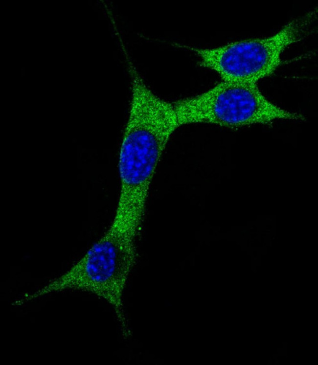 LC3A (Cleaved Gly120) Antibody in Immunocytochemistry (ICC/IF)