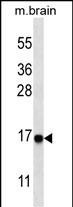 LC3A (Cleaved Gly120) Antibody in Western Blot (WB)