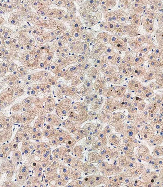 ATG5 Antibody in Immunohistochemistry (Paraffin) (IHC (P))