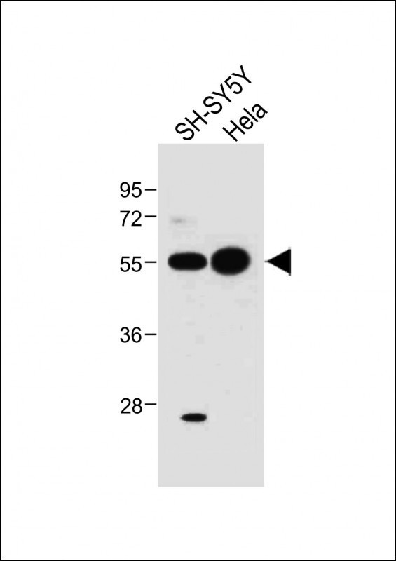 ATG5 Antibody in Western Blot (WB)