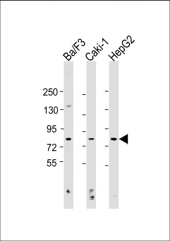 ATG7 Antibody in Western Blot (WB)