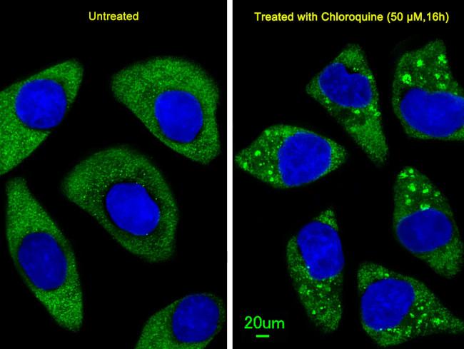 ATG7 Antibody in Immunocytochemistry (ICC/IF)