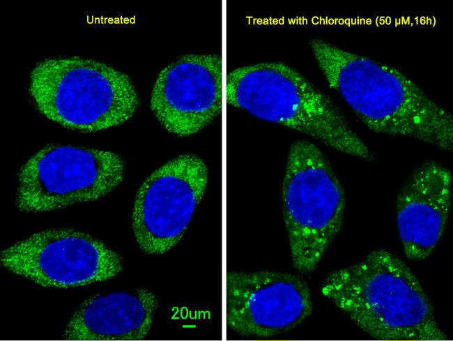 ATG16L1 Antibody in Immunocytochemistry (ICC/IF)