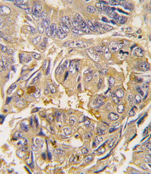 ATG16L1 Antibody in Immunohistochemistry (Paraffin) (IHC (P))