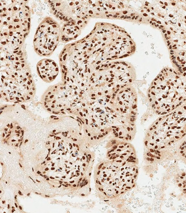 MEOX2 Antibody in Immunohistochemistry (Paraffin) (IHC (P))