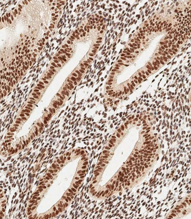 MEOX2 Antibody in Immunohistochemistry (Paraffin) (IHC (P))