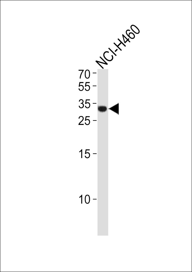 ASCL1 Antibody in Western Blot (WB)