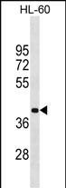 MBD2 Antibody in Western Blot (WB)