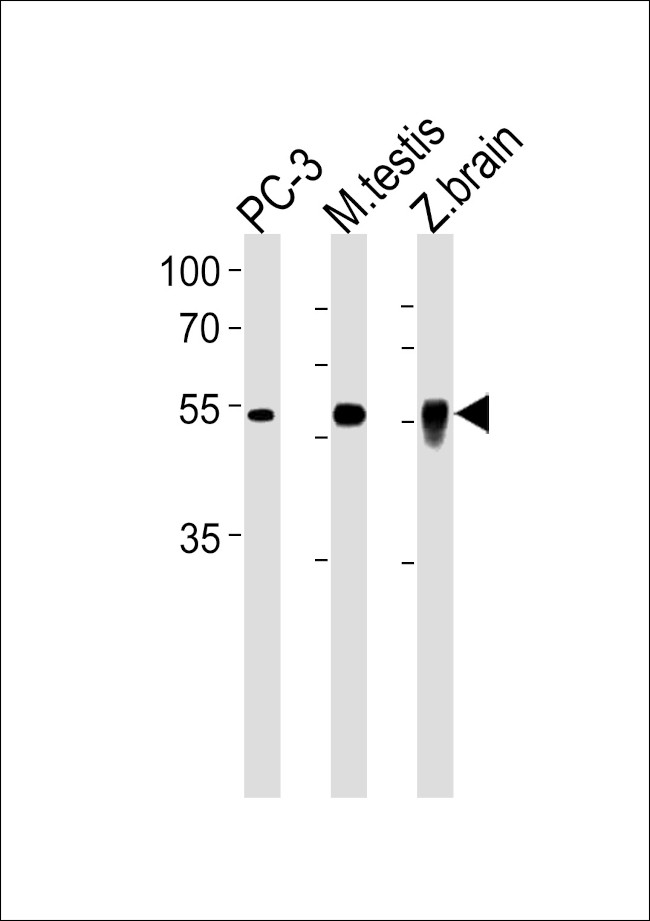 DMRTA2 Antibody in Western Blot (WB)