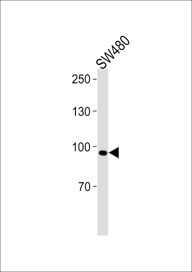 ANO6 Antibody in Western Blot (WB)