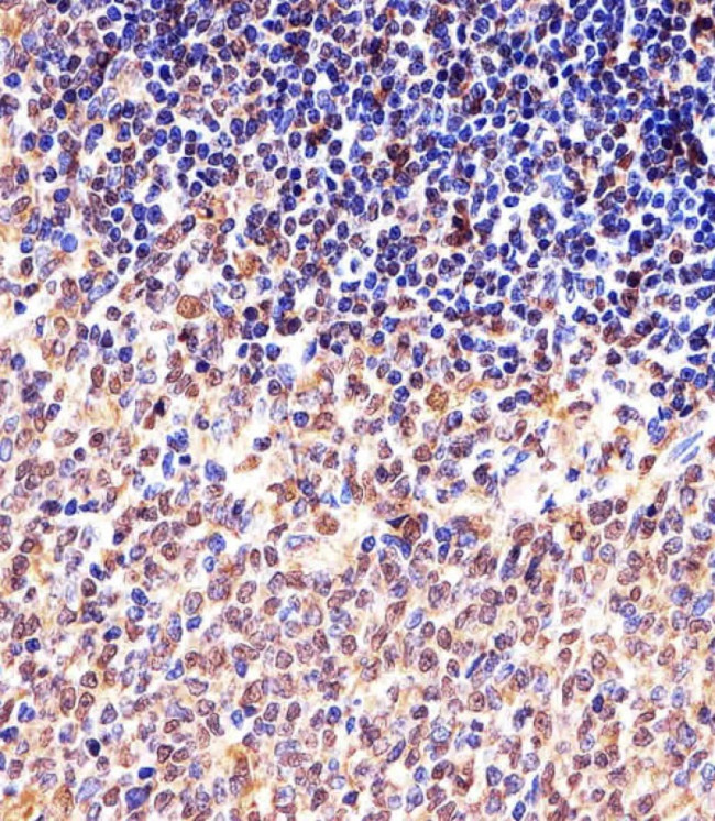 Cyclin B1 Antibody in Immunohistochemistry (Paraffin) (IHC (P))