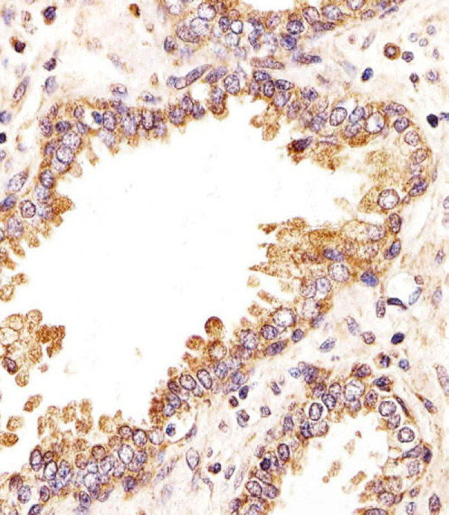 ZRSR2 Antibody in Immunohistochemistry (Paraffin) (IHC (P))