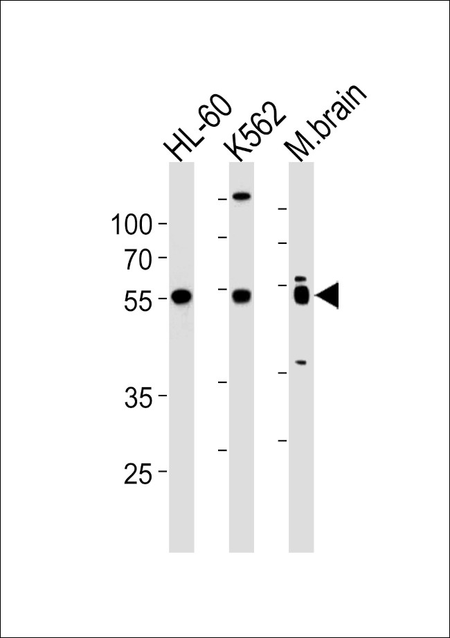 PTGER4 Antibody in Western Blot (WB)