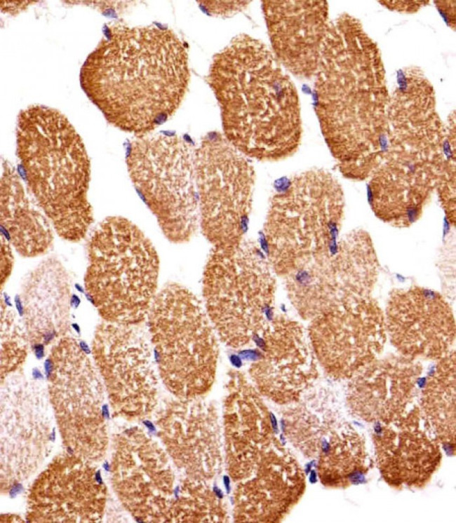 SIRPB1 Antibody in Immunohistochemistry (Paraffin) (IHC (P))