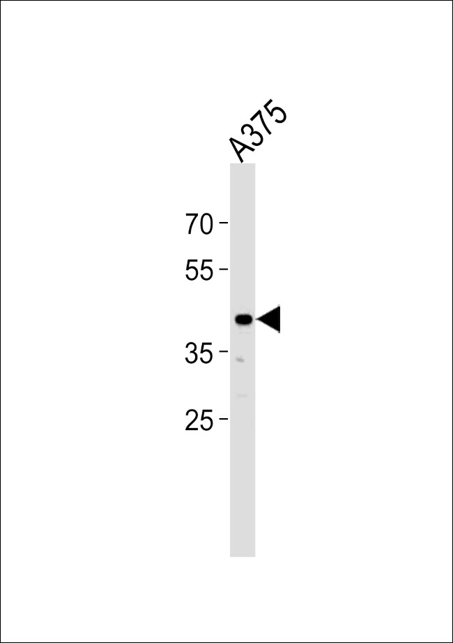 SIRPB1 Antibody in Western Blot (WB)