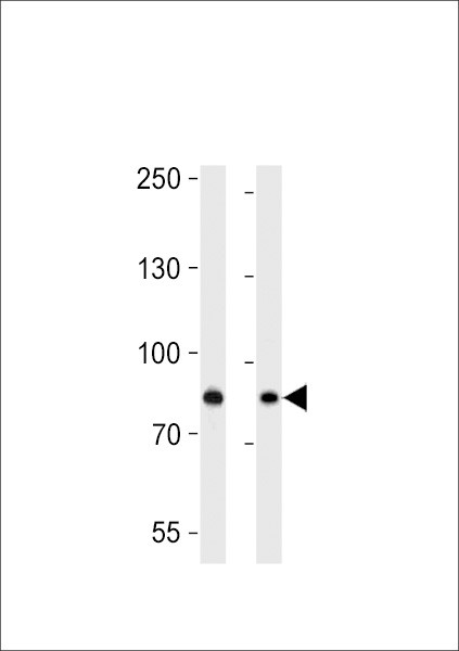 USP51 Antibody in Western Blot (WB)