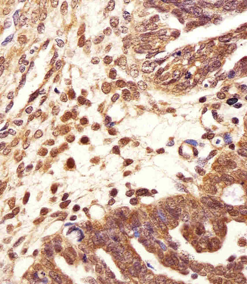 PSMB2 Antibody in Immunohistochemistry (Paraffin) (IHC (P))