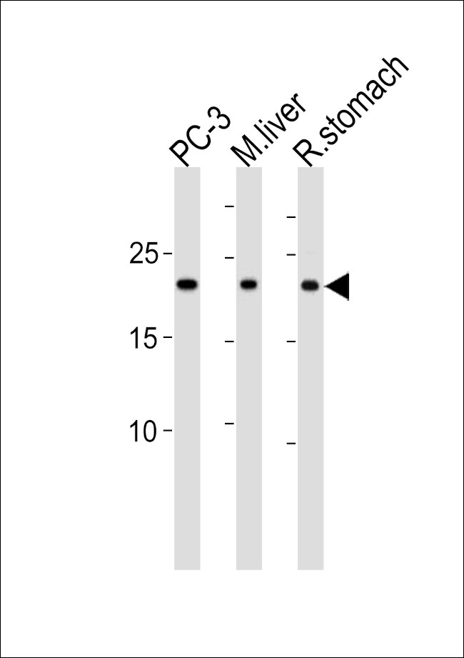 PSMB2 Antibody in Western Blot (WB)