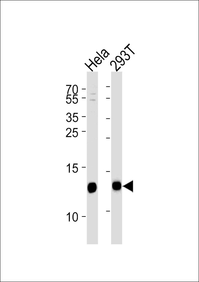 VAMP8 Antibody in Western Blot (WB)