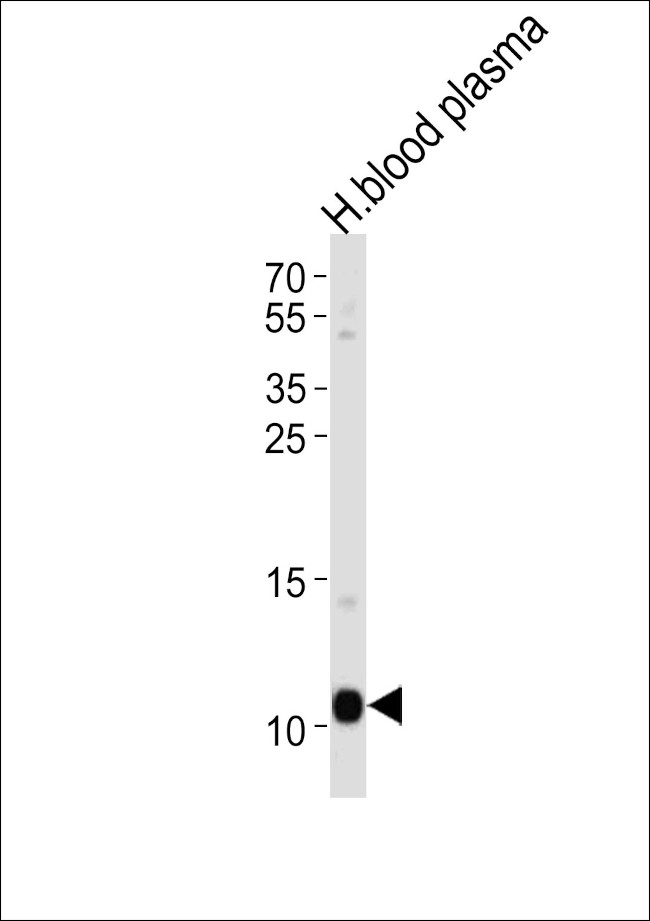 ApoA2 Antibody in Western Blot (WB)