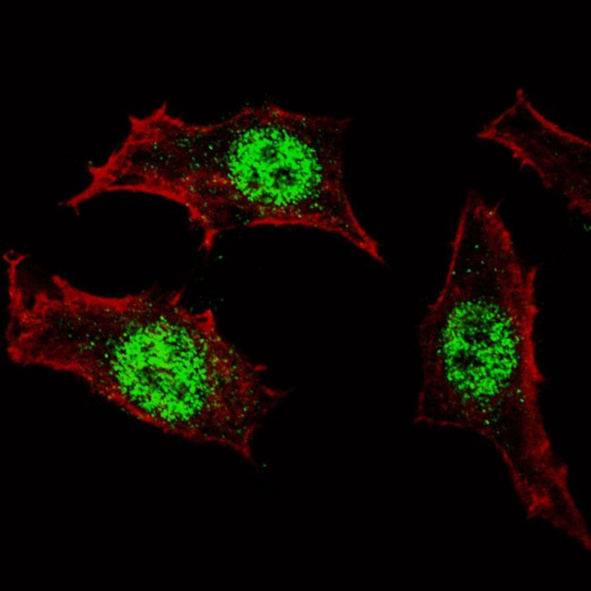 KLF4 Antibody in Immunocytochemistry (ICC/IF)