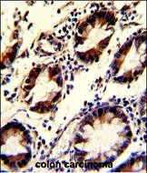 KLF4 Antibody in Immunohistochemistry (Paraffin) (IHC (P))