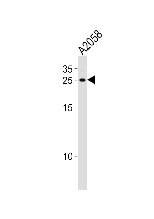 APRT Antibody in Western Blot (WB)