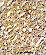 DDAH1 Antibody in Immunohistochemistry (Paraffin) (IHC (P))