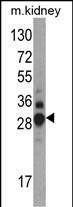 DDAH1 Antibody in Western Blot (WB)